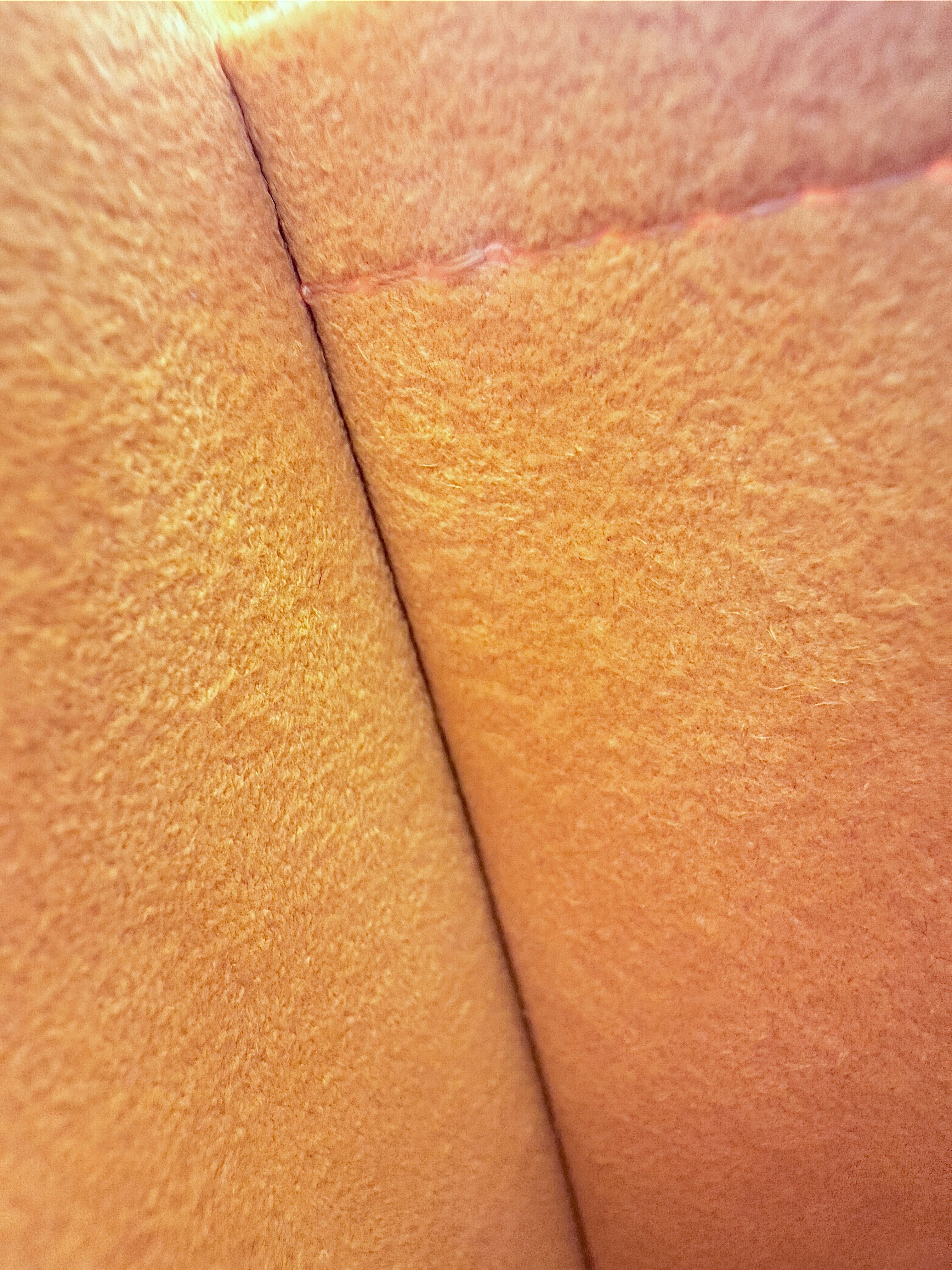 Louis Vuitton epi leather Citron yellow Alma PM